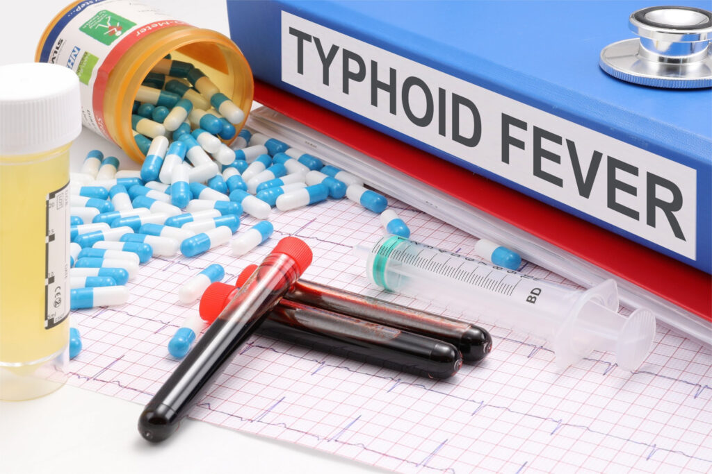 टाइफाइड(Typhoid) क्या है?