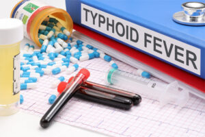 Read more about the article टाइफाइड(Typhoid) क्या है?