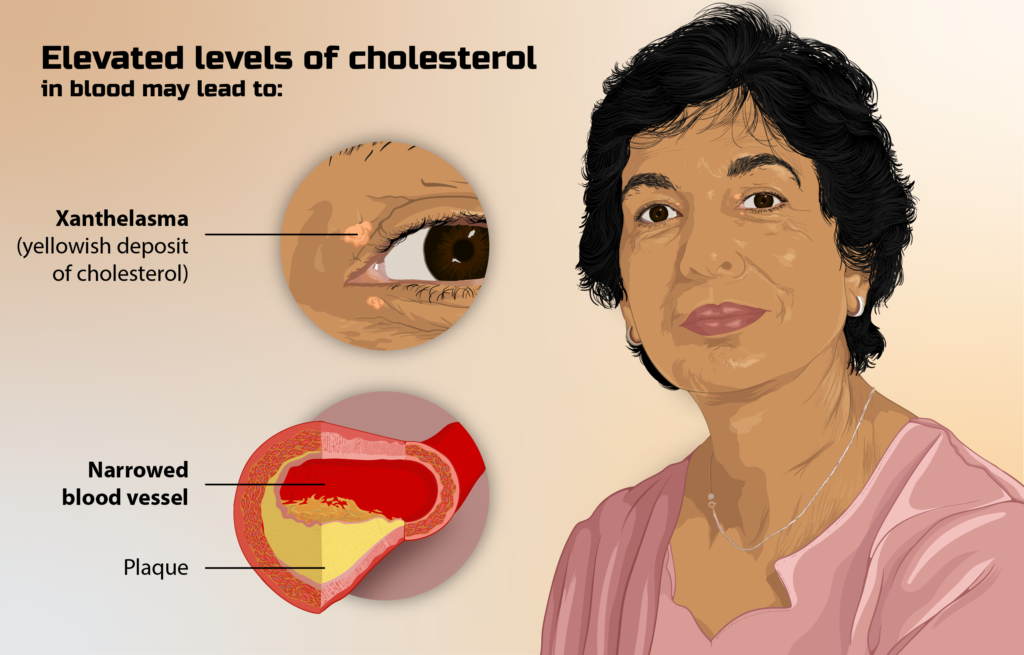 कोलेस्ट्रॉल Cholesterol
