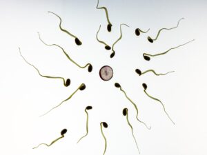 Read more about the article Low Sperm Count Signs