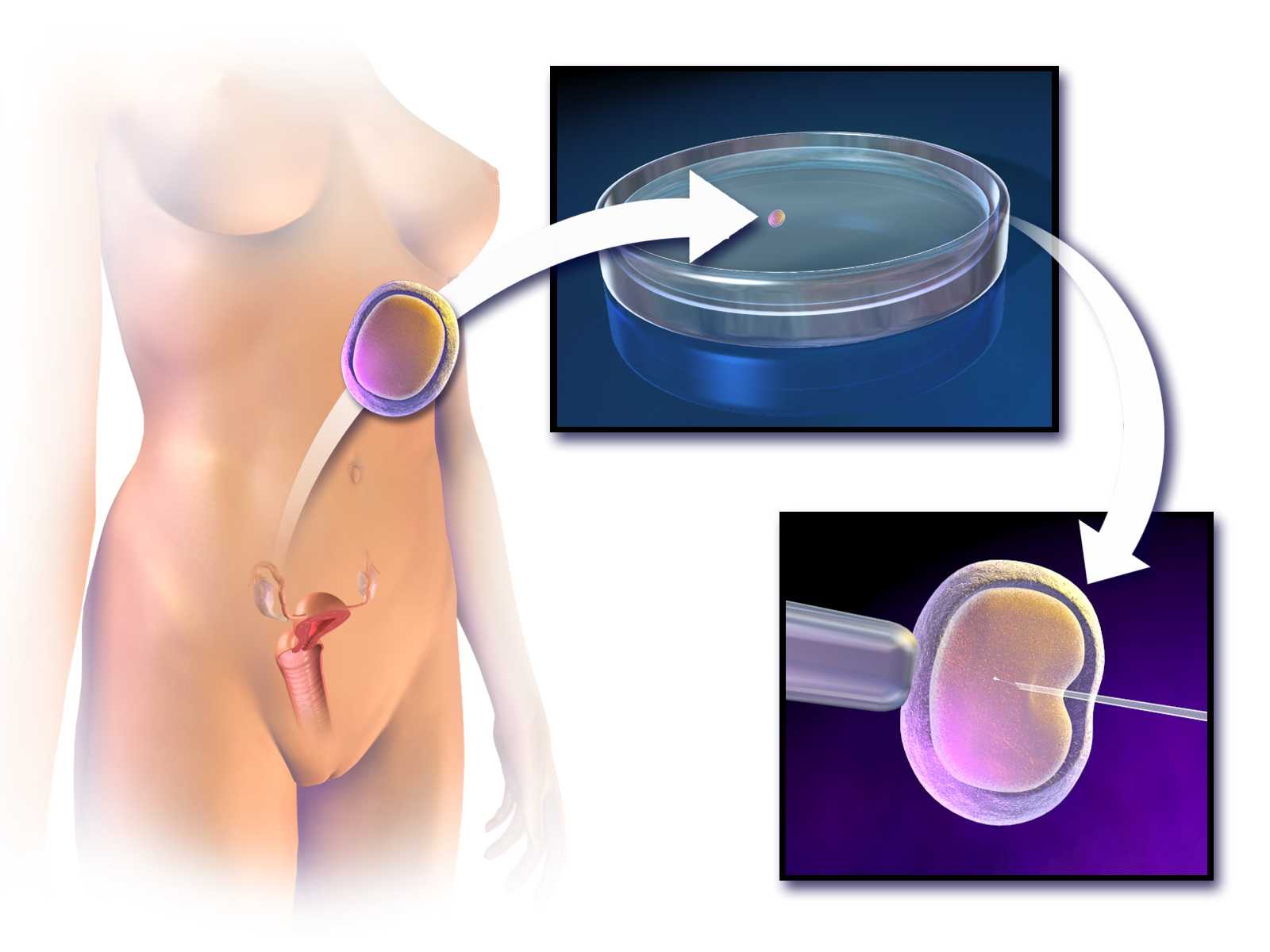 You are currently viewing IVF Procedure: Guide to In Vitro Fertilization
