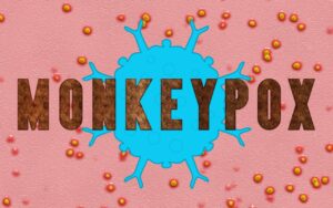 Read more about the article Monkeypox Symptoms vs. COVID-19