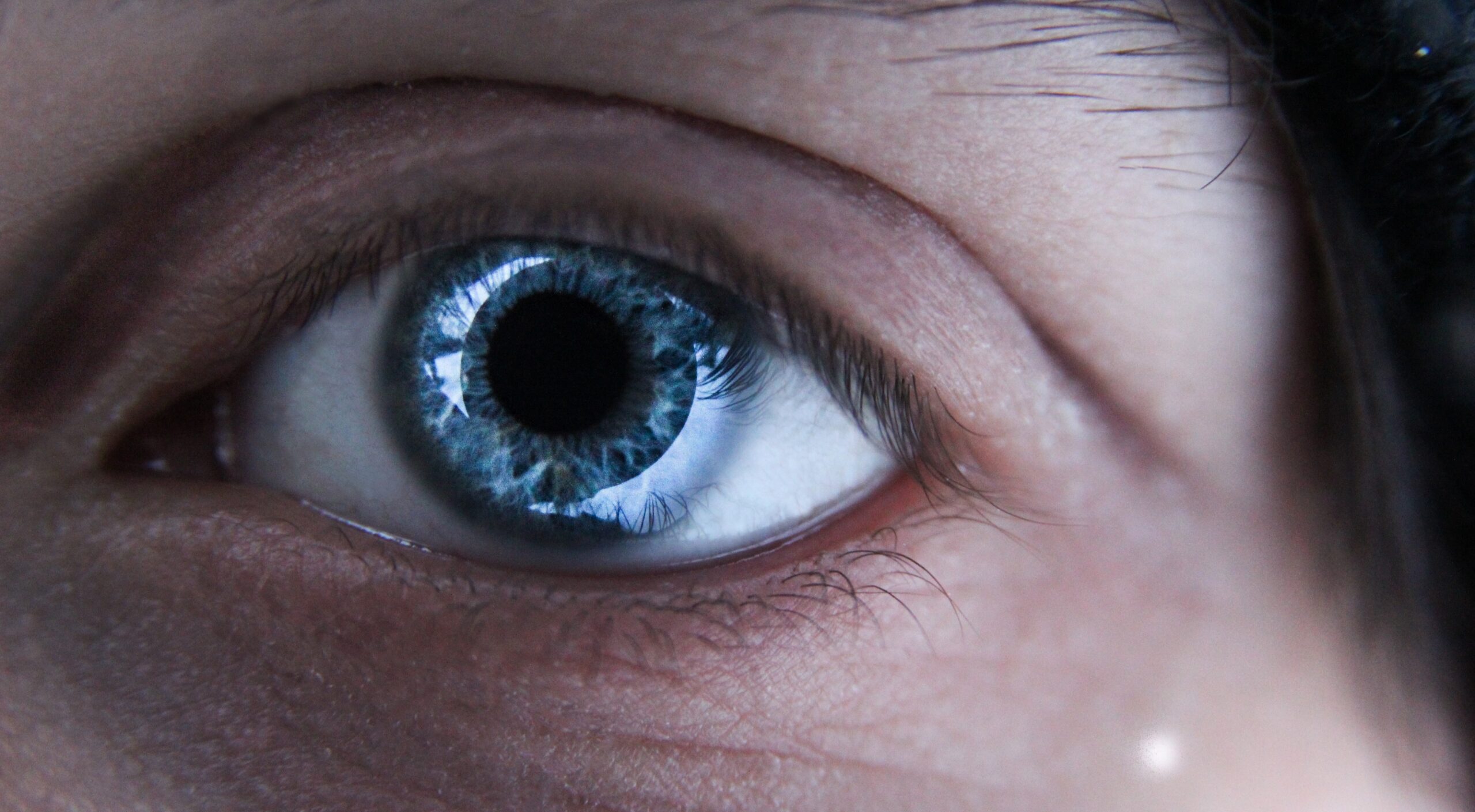 You are currently viewing LASIK Relief: Managing Dry Eyes After Surgery