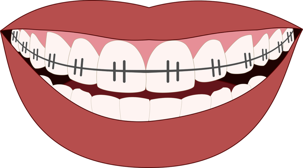 Adult Braces Cost: Factors, Insights, and Managing Expenses