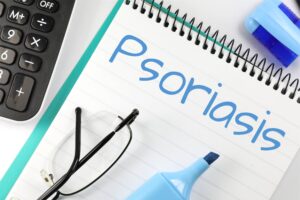 Read more about the article Psoriasis Causes and Symptoms: Decoding the Skin Mystery