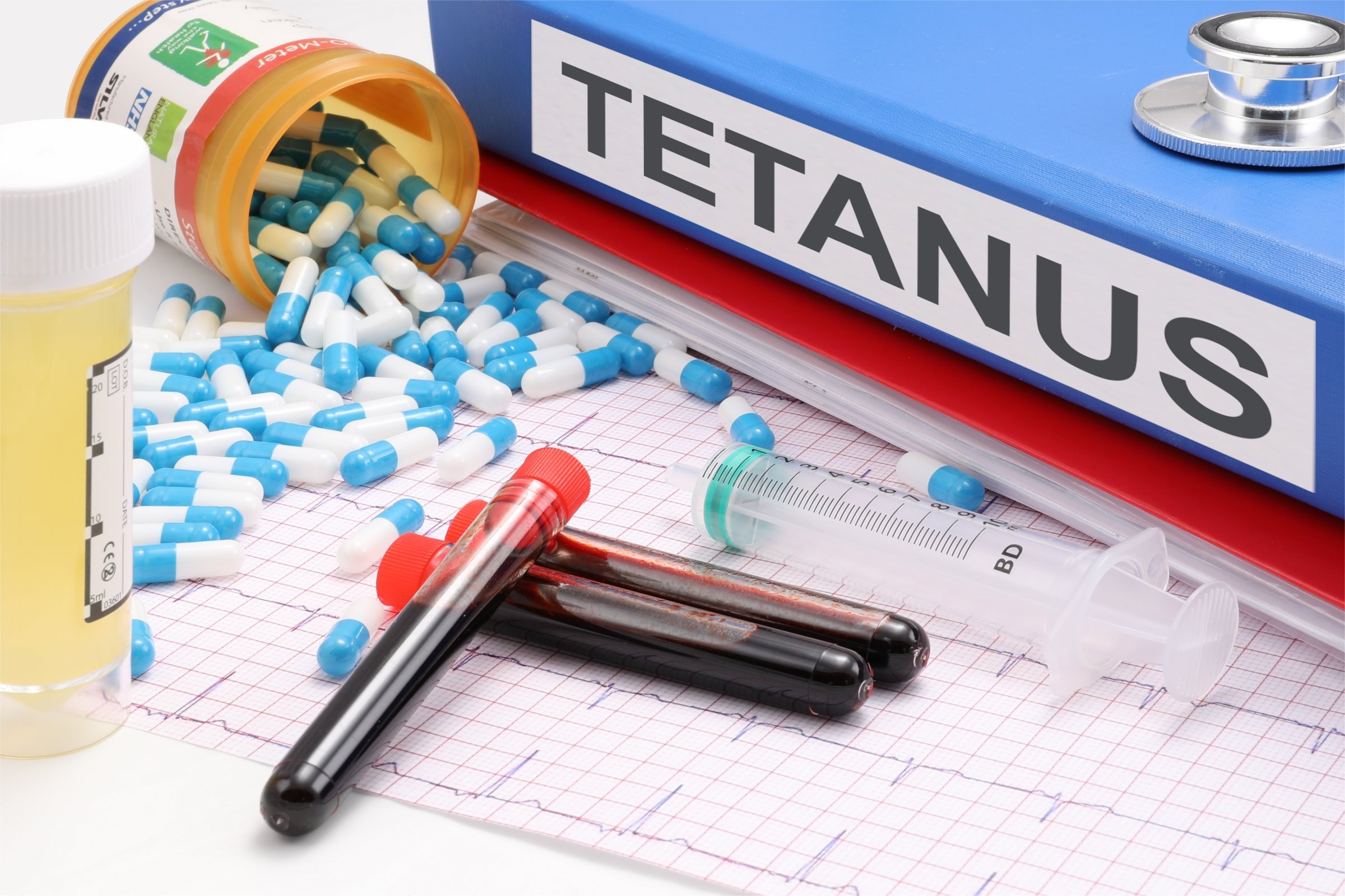 You are currently viewing Tetanus Symptoms: Understanding the Signs of Tetanus Infection