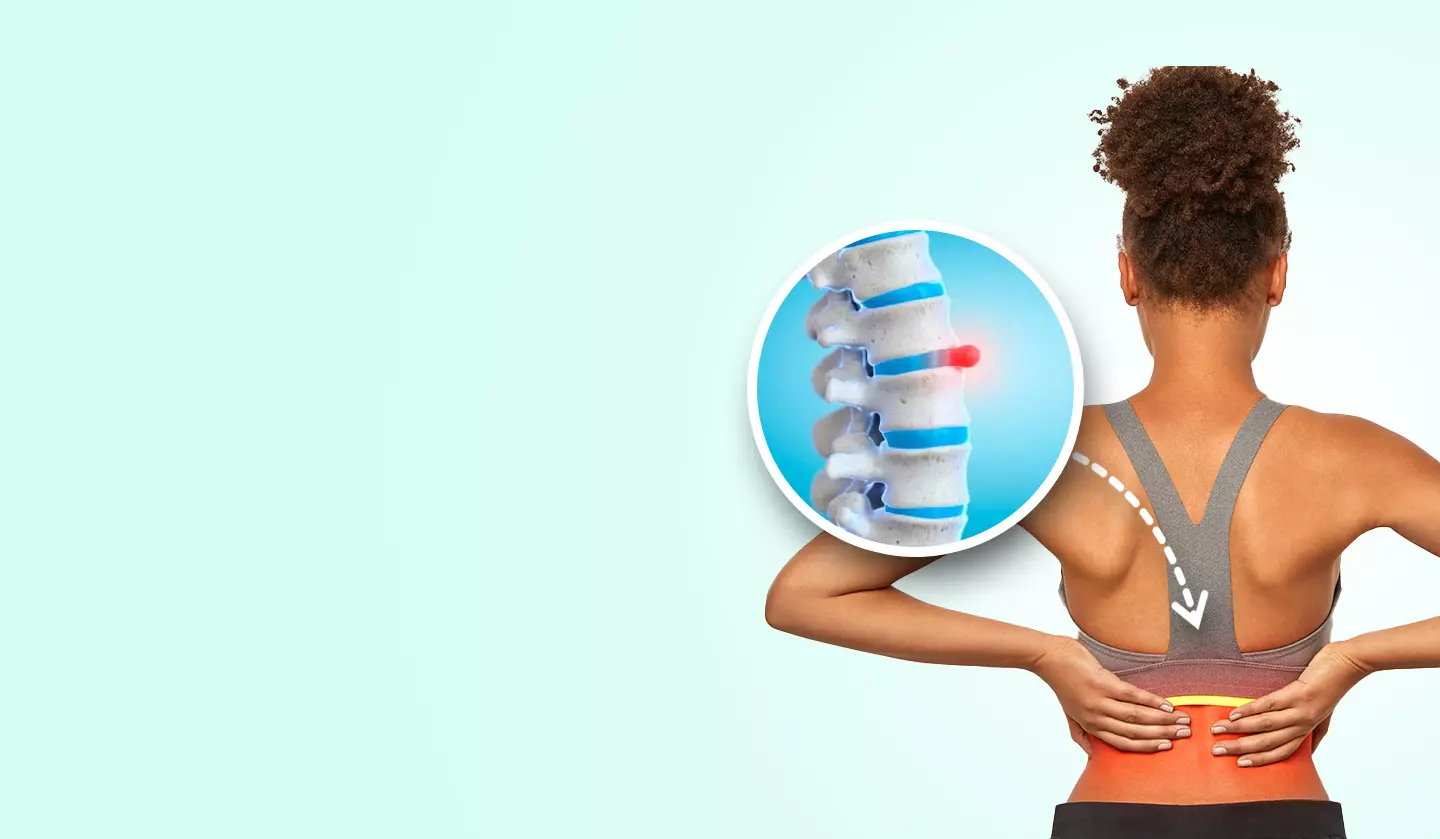 Read more about the article Slipped Disc Treatment