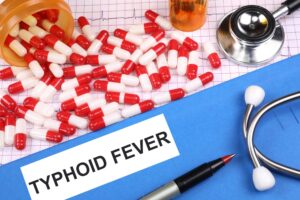 Read more about the article Unveiling the Silent Threat: What is Typhoid and How to Protect Yourself